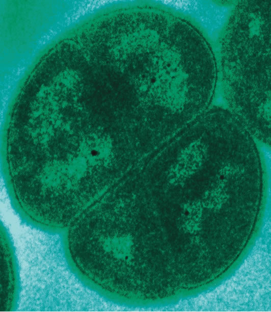 Deinococcus felix moronta