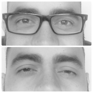 astigmatismo selfie felix moronta